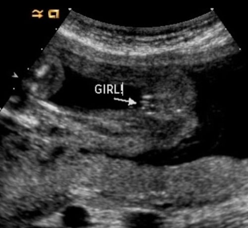 Little People Big World: Audrey Roloff - Jeremy Roloff