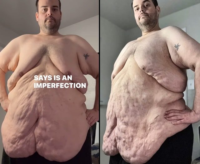 Wess Schulze From My 600-lb Life, TLC, Sourced From @my600lblifewess Instagram