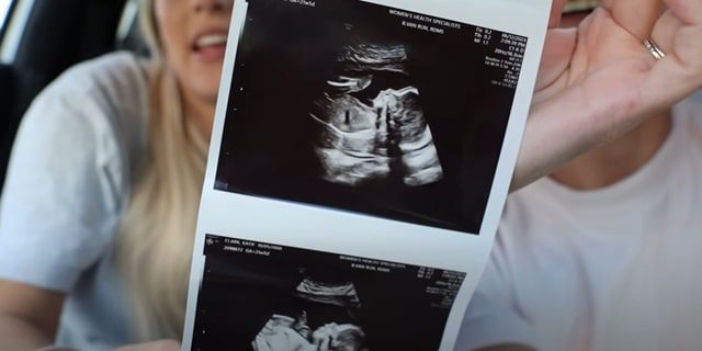Travis Clark & Katie Bates From Bringing Up Bates, Sourced From Travis and Katie YouTube