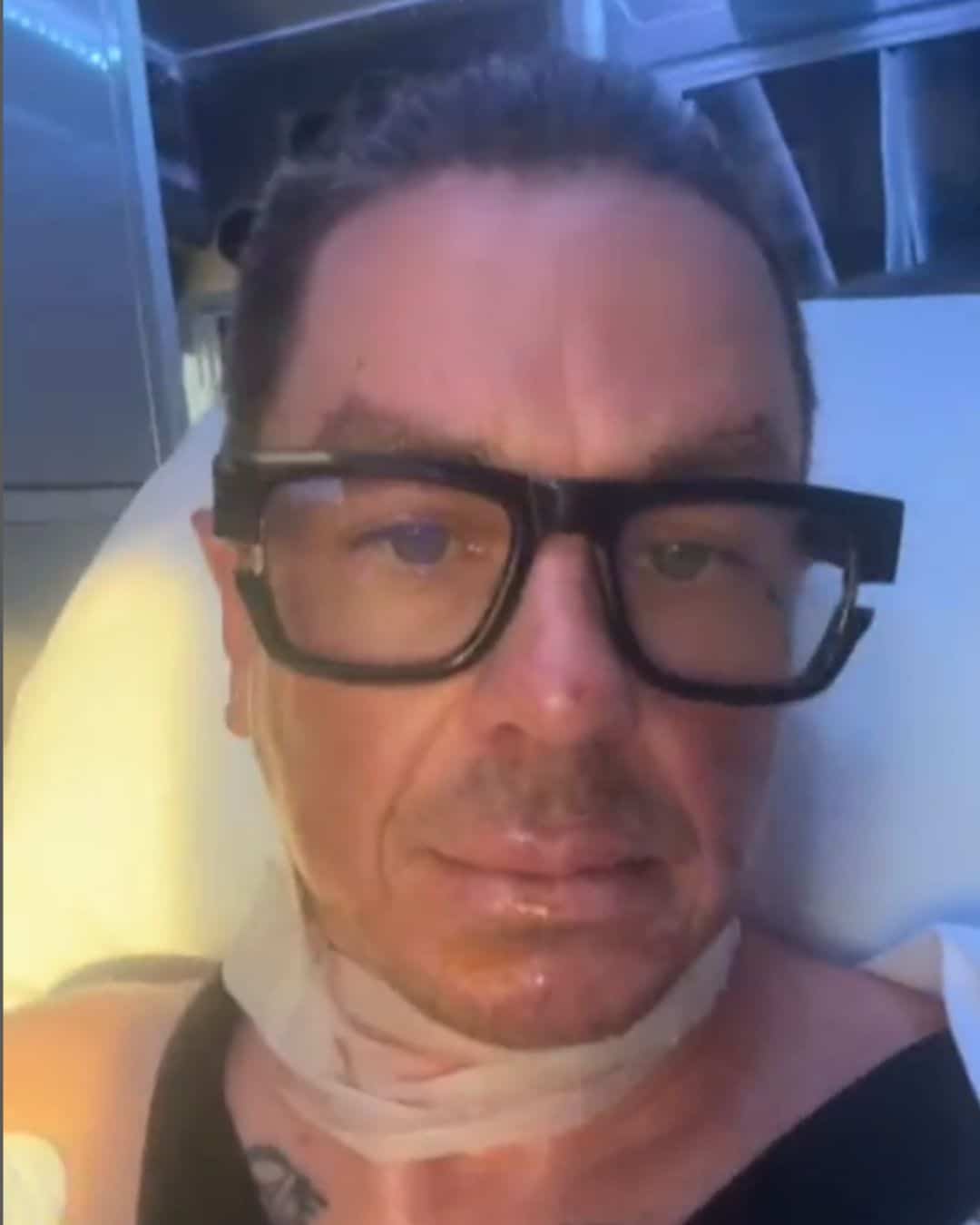 Sid Wilson in hospital with serious burns