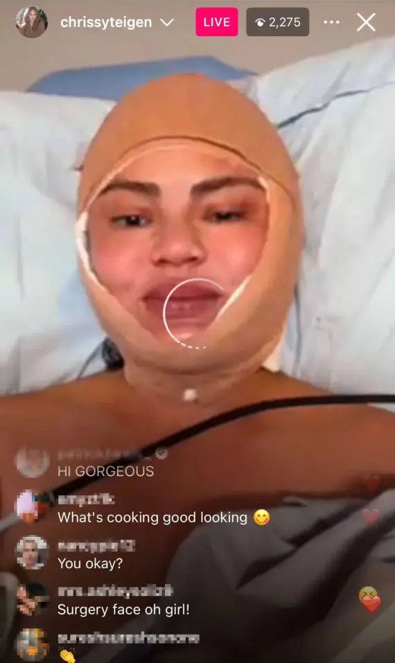 Credit: Chrissy Teigen Instagram