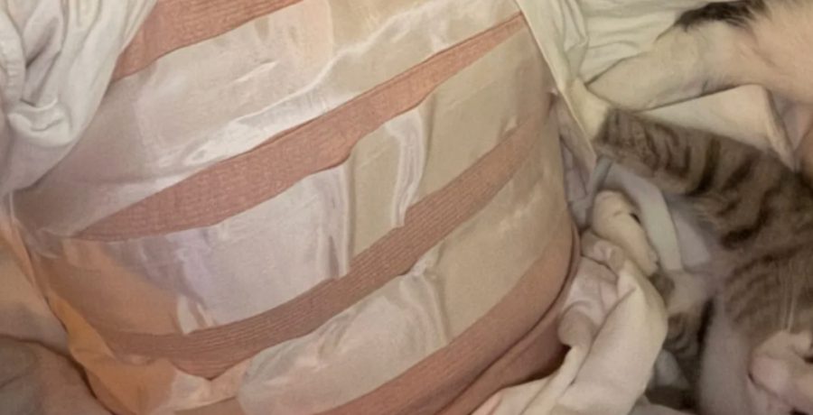 Leticia Cline's bandages - IG