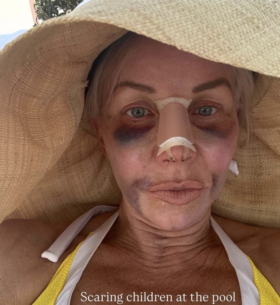 Margaret Josephs- Instagram