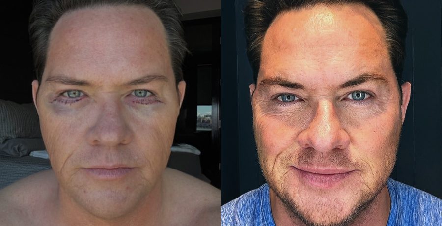 Paulie Connell's before-and-after - IG