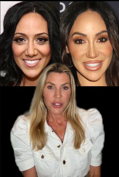 Jen Armstrong speculates on Melissa Gorga's plastic surgery/Credit: YouTube