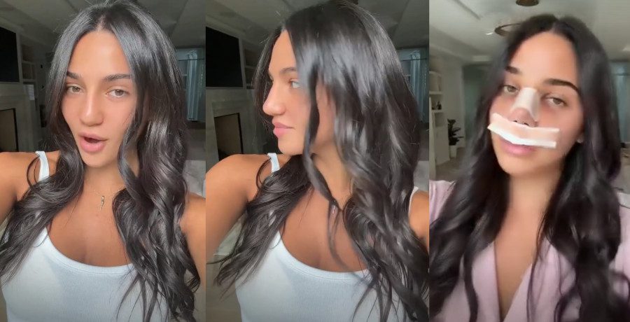 Antonia Gorga shows off bruise and bandaged face after nose job/Credit: Instagram